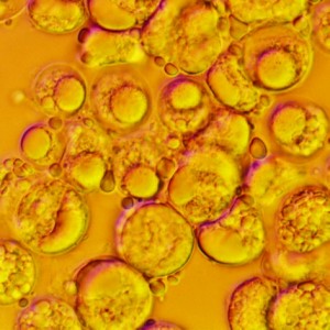 DHA Algae Gold